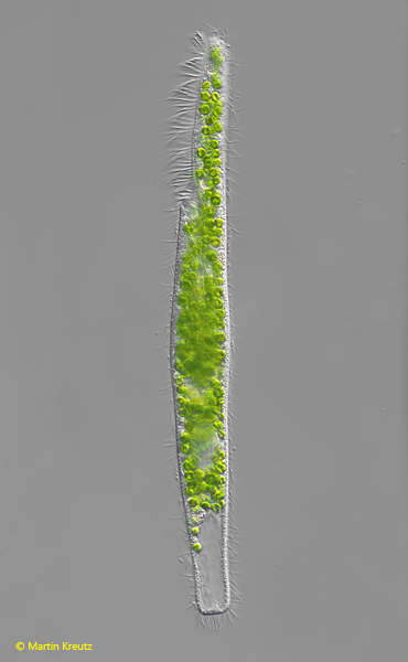 Pseudoblepharisma-chlorelligera