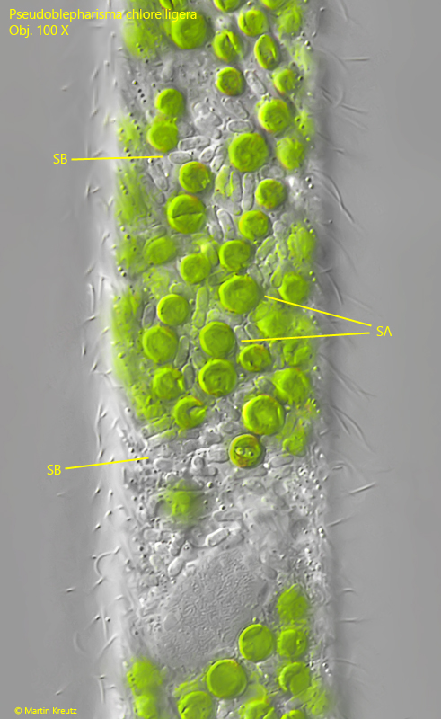 Pseudoblepharisma-chlorelligera