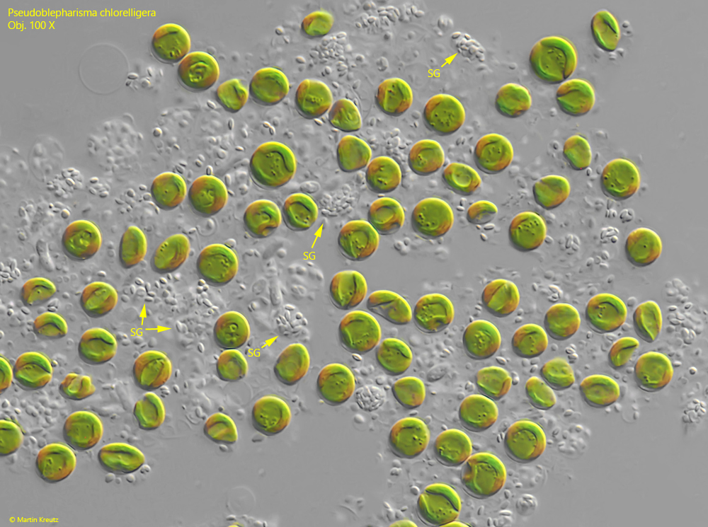Pseudoblepharisma-chlorelligera