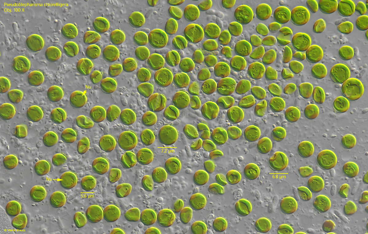 Pseudoblepharisma-chlorelligera