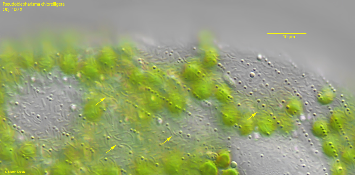 Pseudoblepharisma-chlorelligera