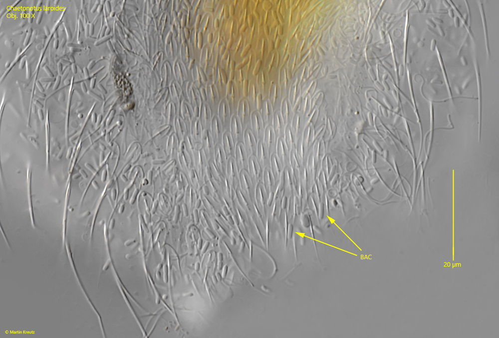 Chaetonotus-laroides
