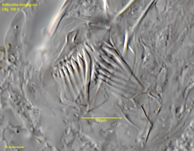 Kellicottia-longispina