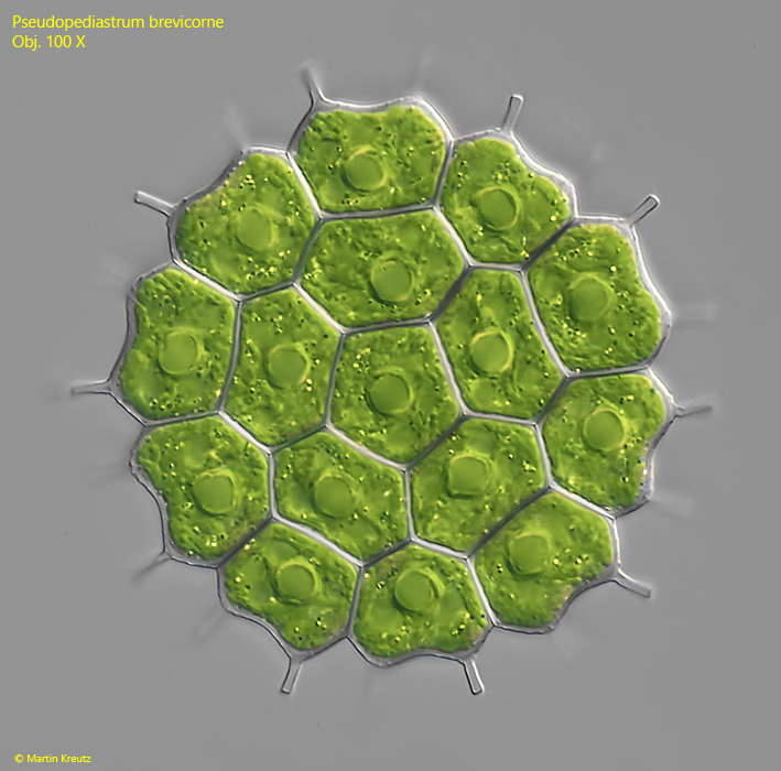 Pseudopediastrum-brevicorne