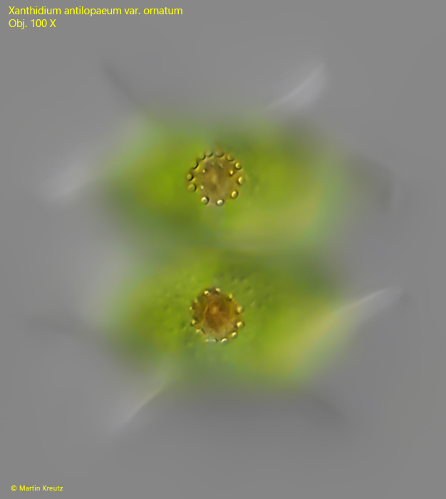 Xanthidium-antilopaeum-var-ornatum
