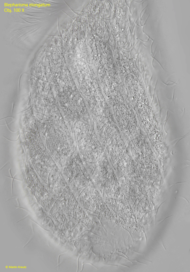 Blepharisma-elongatum