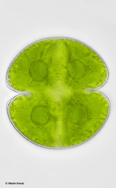 Cosmarium-perforatum-var-rauchii