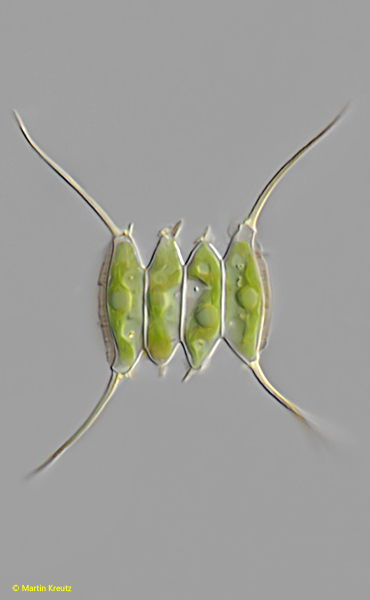 Desmodesmus-opoliensis-var-carinatus