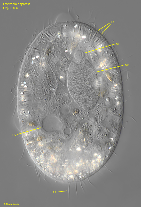 Frontonia-depressa