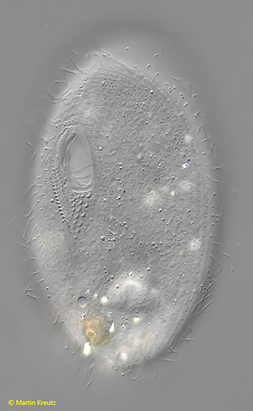 Frontonia-depressa