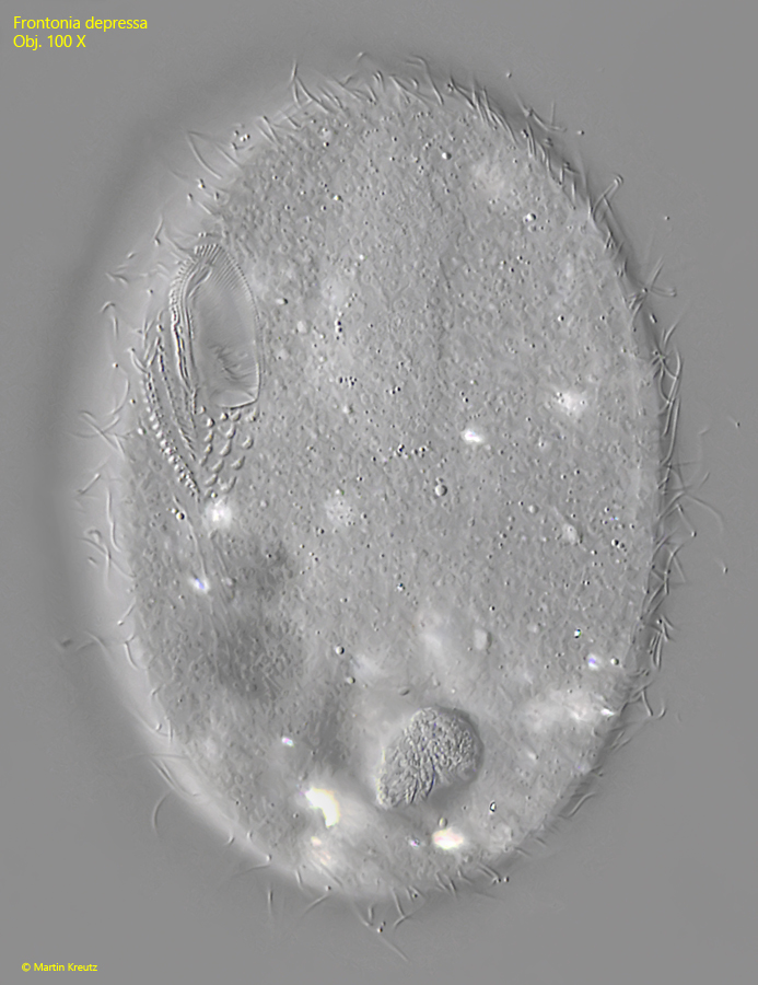 Frontonia-depressa