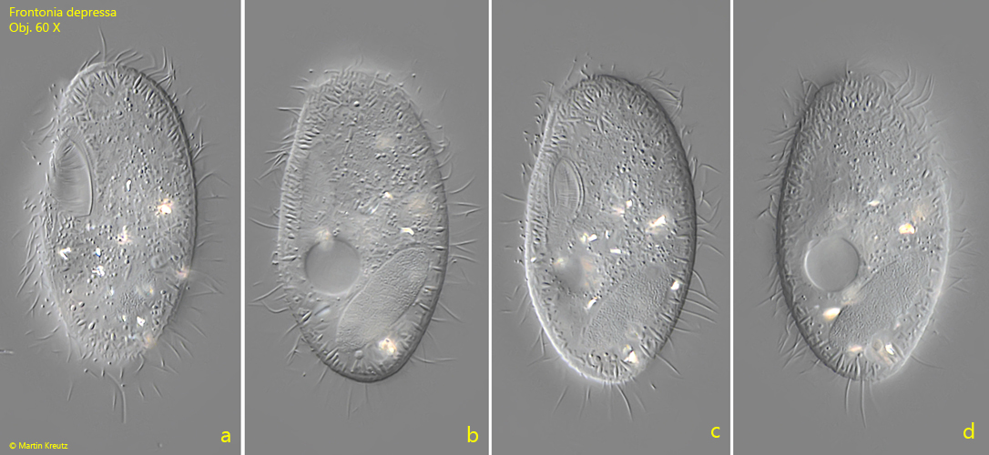Frontonia-depressa