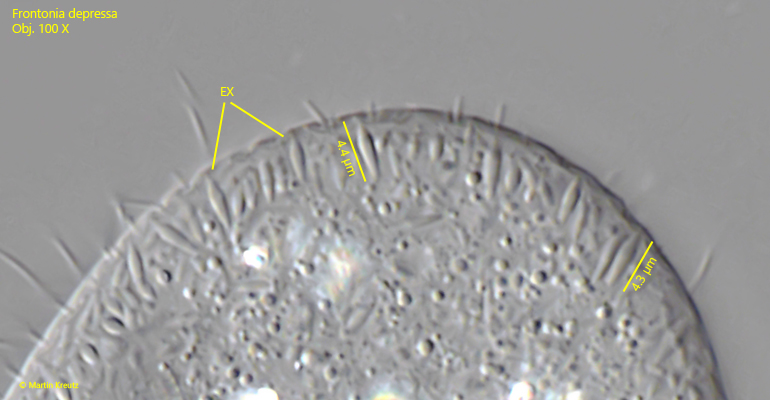 Frontonia-depressa