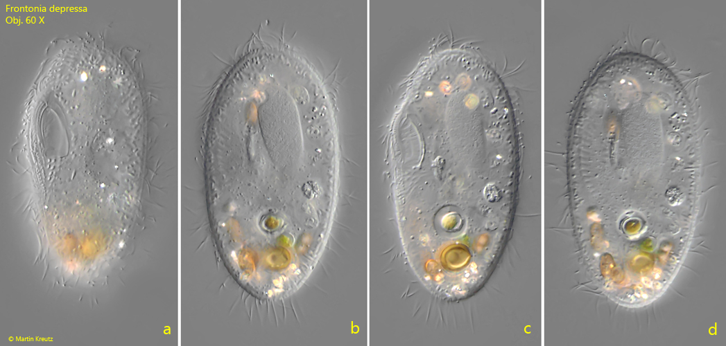 Frontonia-depressa