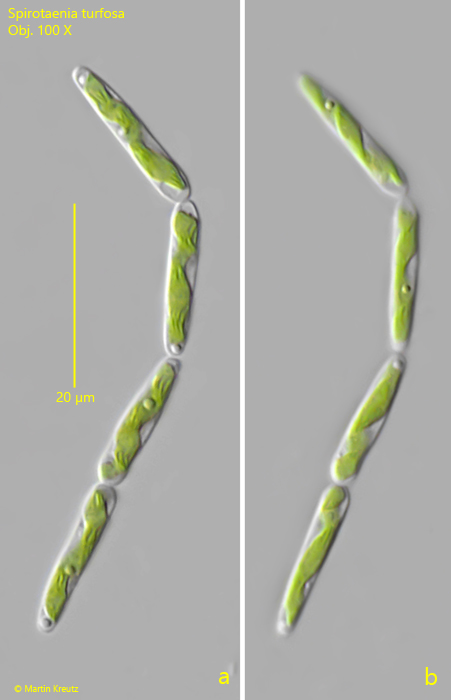 Spirotaenia-turfosa