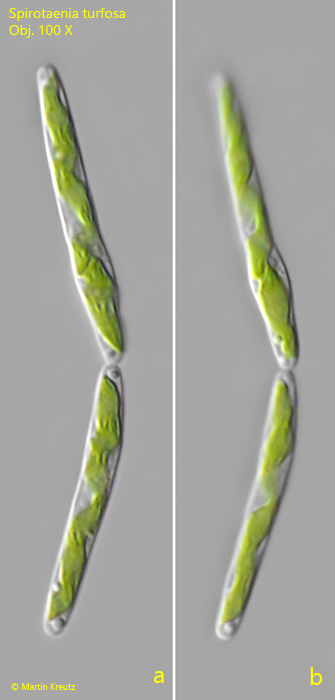 Spirotaenia-turfosa