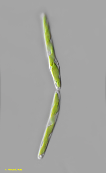 Spirotaenia-turfosa