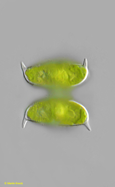 Staurodesmus-dejectus-f-apiculatus
