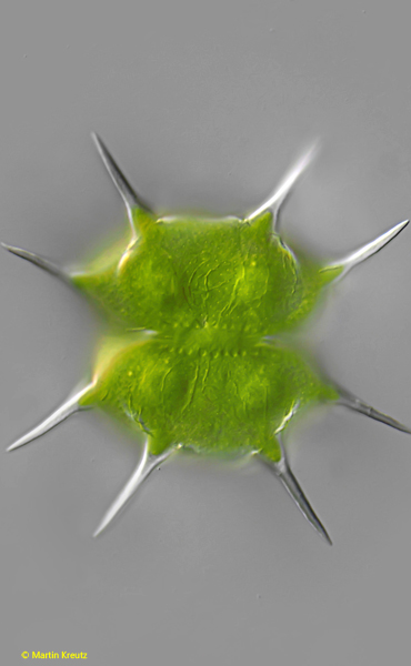 Xanthidium-basiornatum