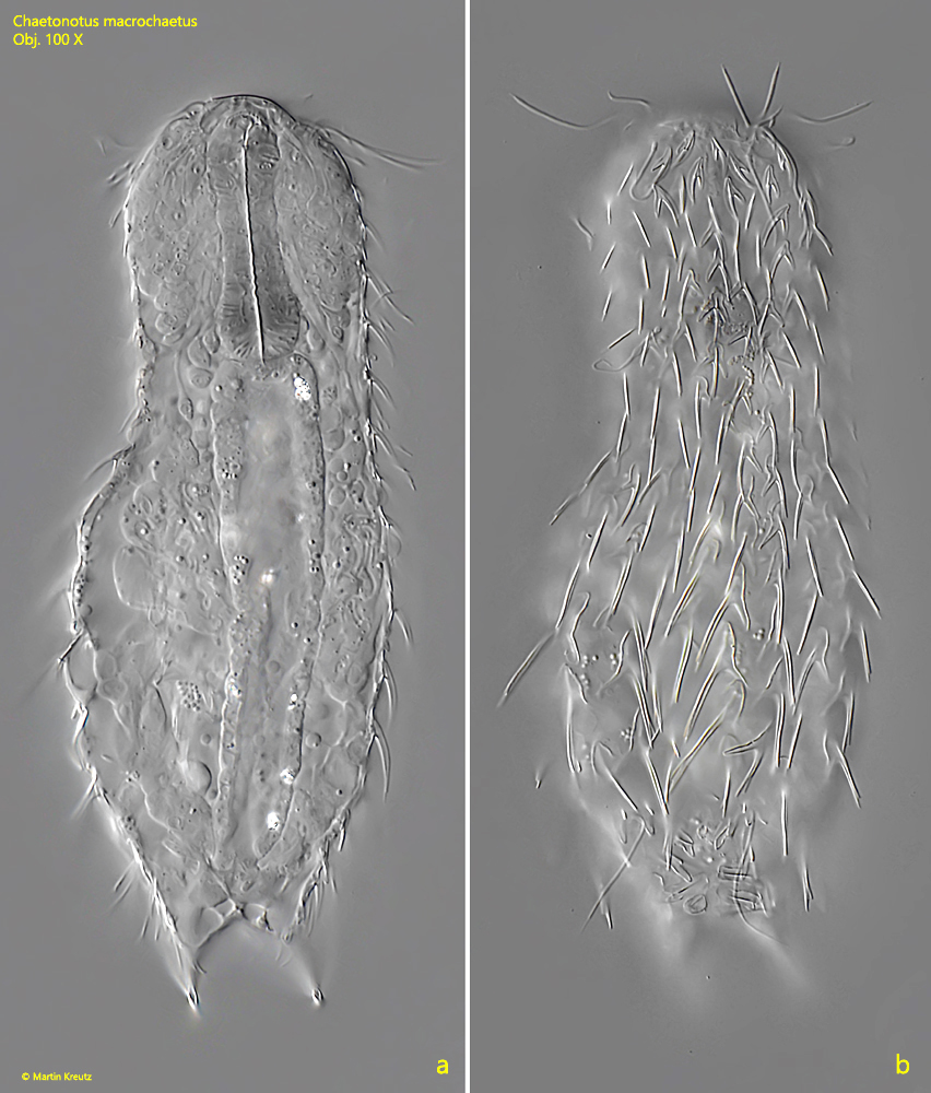 Chaetonotus-macrochaetus