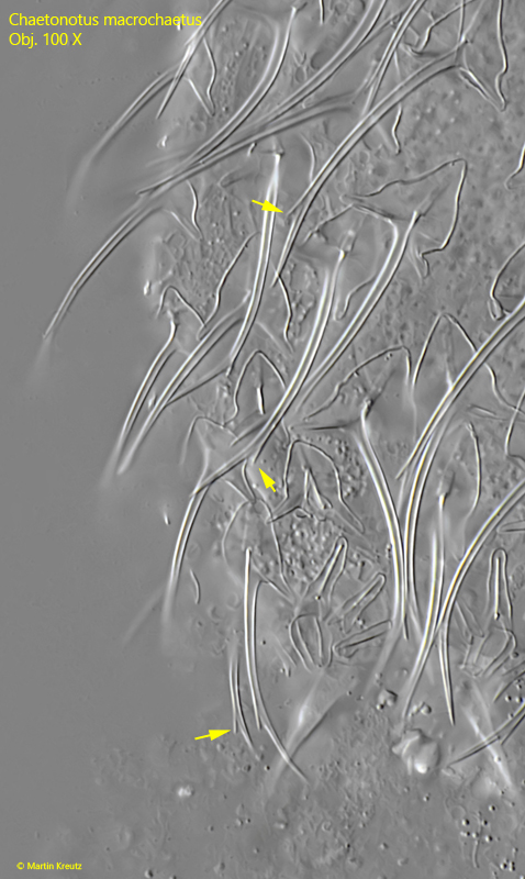 Chaetonotus-macrochaetus
