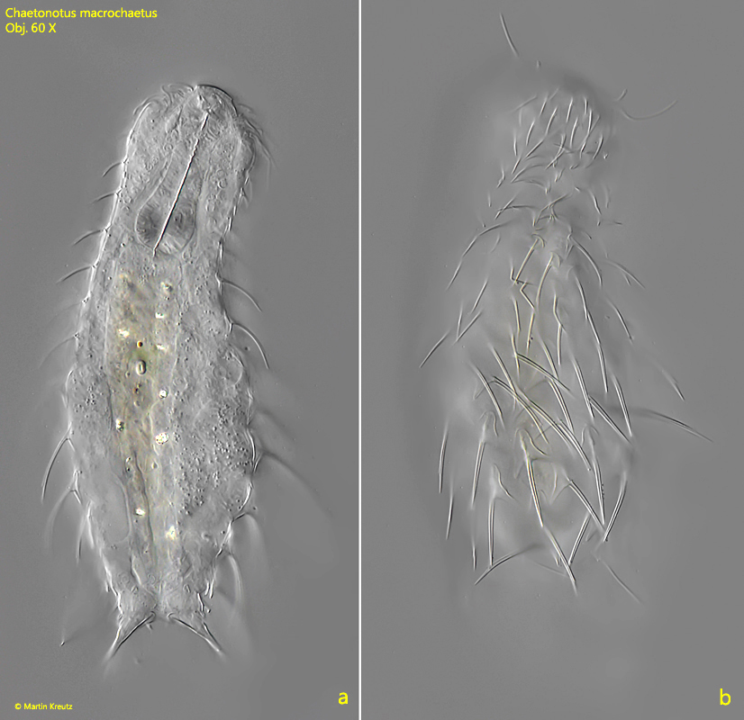 Chaetonotus-macrochaetus
