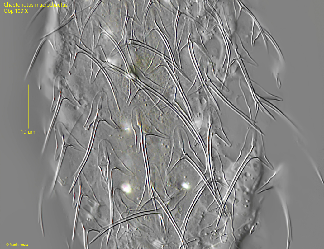 Chaetonotus-macrochaetus