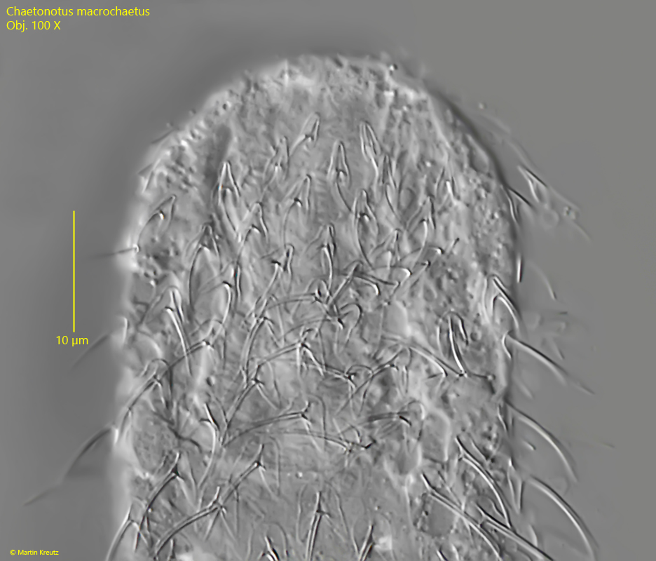Chaetonotus-macrochaetus