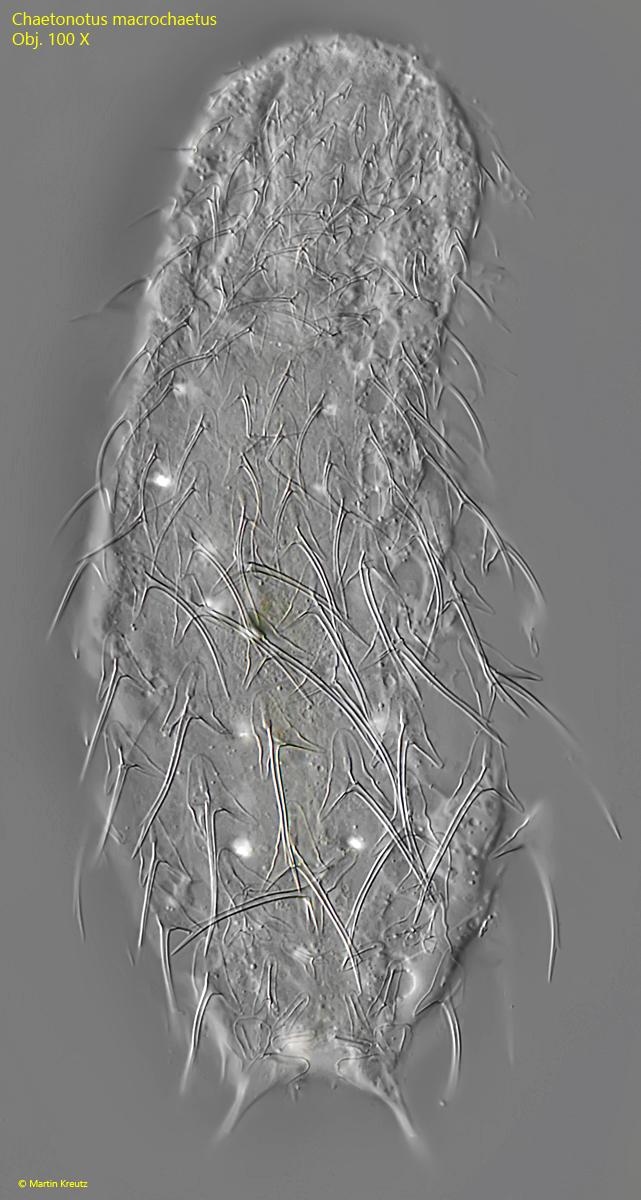 Chaetonotus-macrochaetus