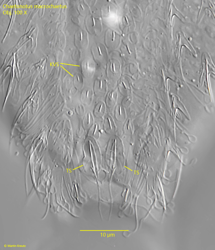 Chaetonotus-macrochaetus