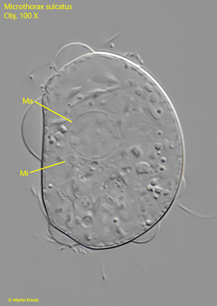 Microthorax-sulcatus