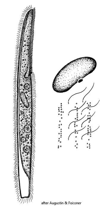 Spirostomum-teres