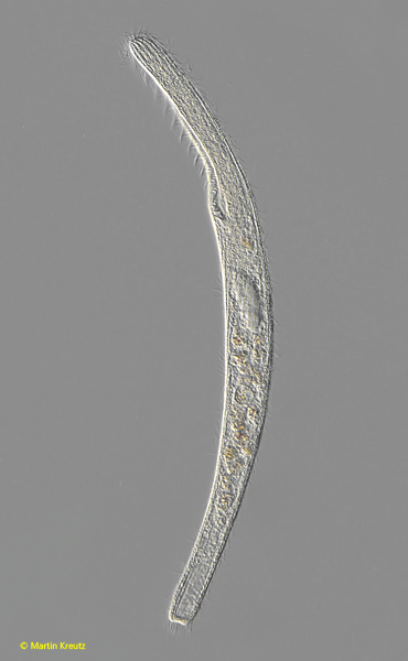 Spirostomum-teres