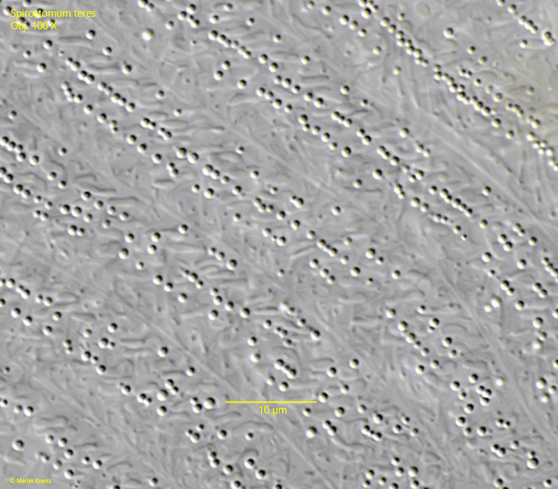 Spirostomum-teres