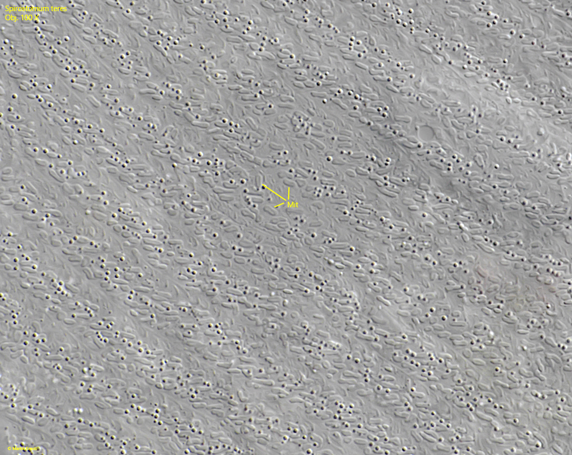 Spirostomum-teres