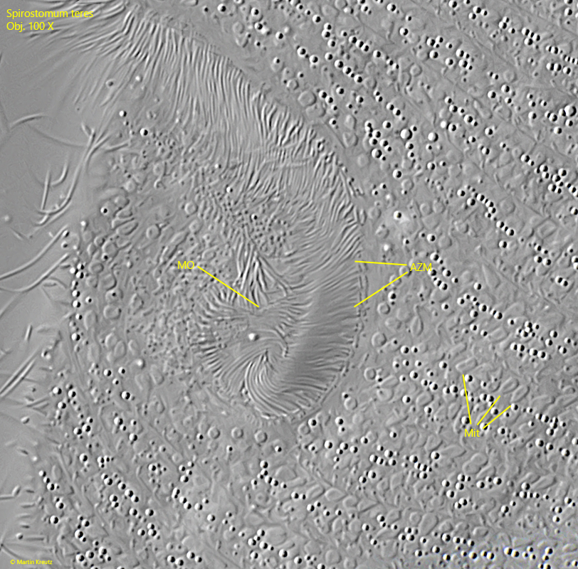Spirostomum-teres