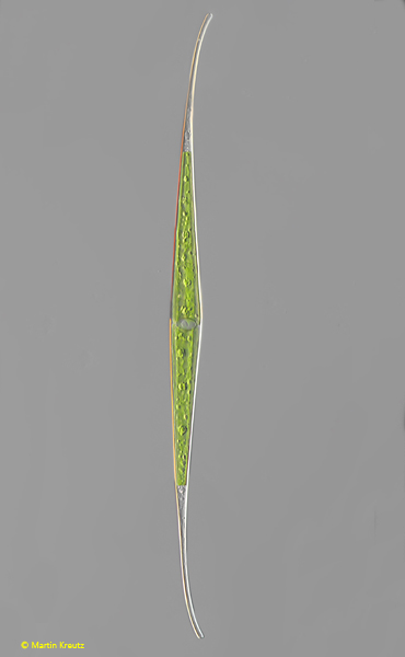 Closterium-kuetzingii