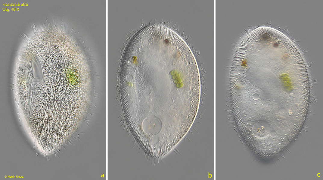 Frontonia-atra