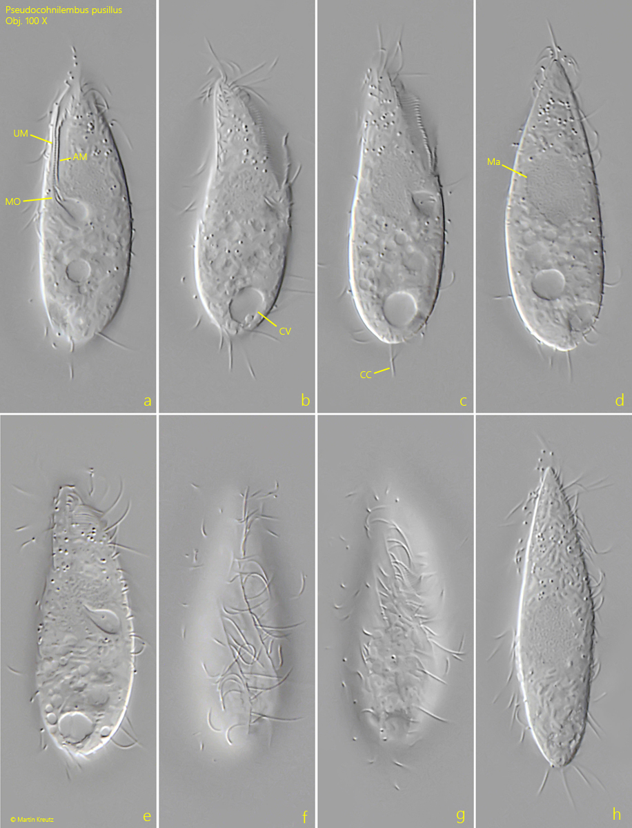 Pseudocohnilembus pusillus