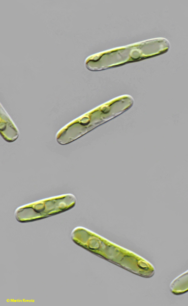 Spirotaenia-cf-endospira