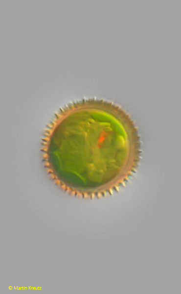 Trachelomonas-globulosa-f-punctata
