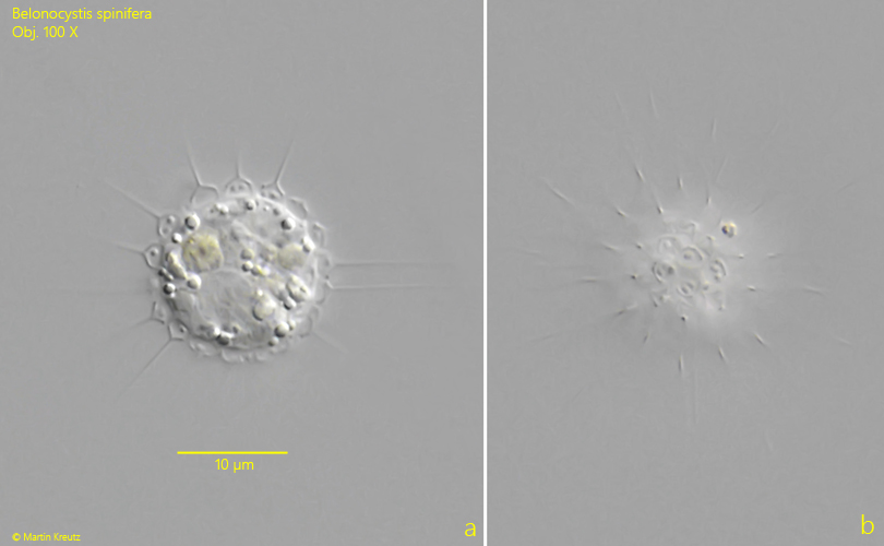 Belonocystis-spinifera