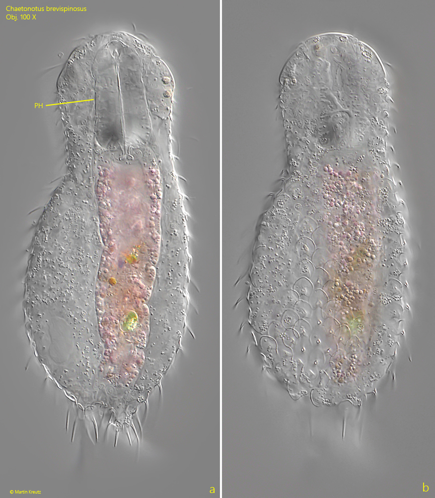 Chaetonotus-brevispinosus