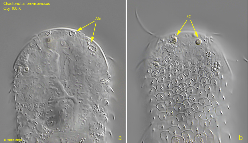 Chaetonotus brevispinosus