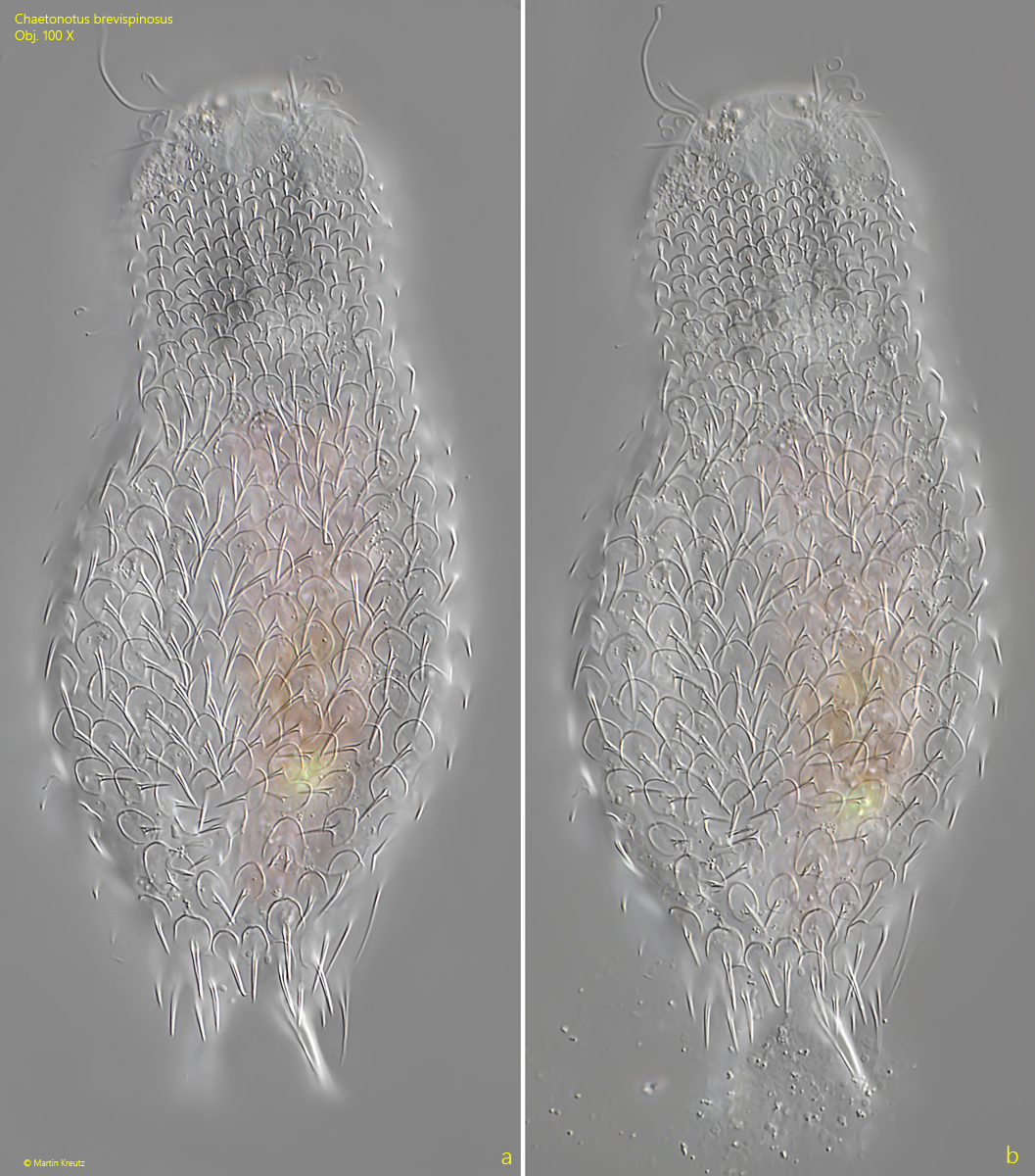 Chaetonotus-brevispinosus