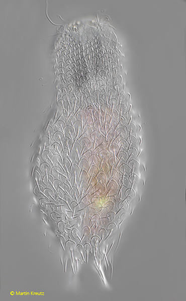 Chaetonotus-brevispinosus