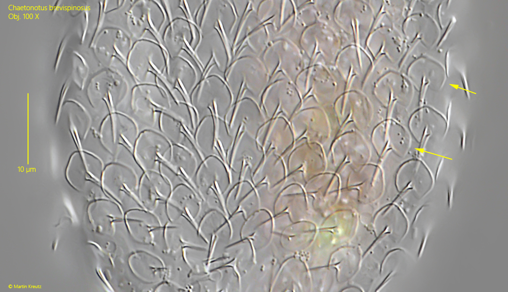 Chaetonotus-brevispinosus
