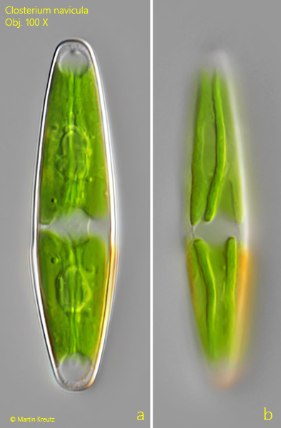 Closterium-navicula