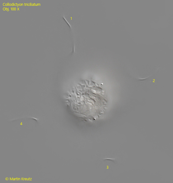 Collodictyon-triciliatum