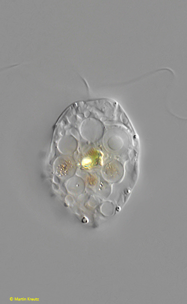 Collodictyon-triciliatum